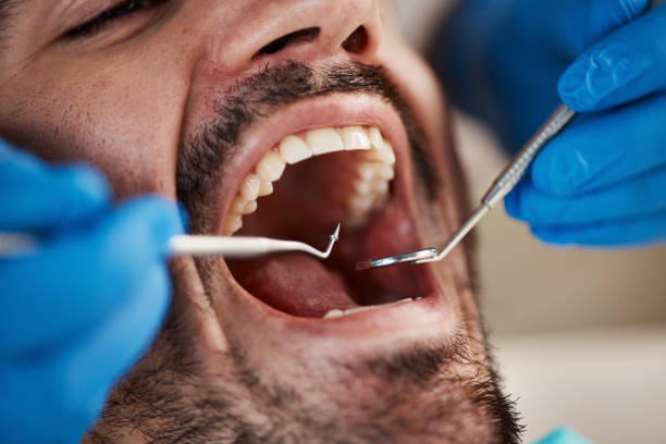 Best Mobile Emergency Dentist in Riverton, UT